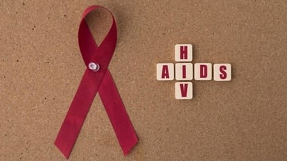 HIV Aids